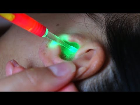 *NEW* ASMR Ear Cleaning w. LIGHT UP EAR PICK, Jumbo Q-tips, Rubber/ Fluffy Ear Picks + Ear Massage