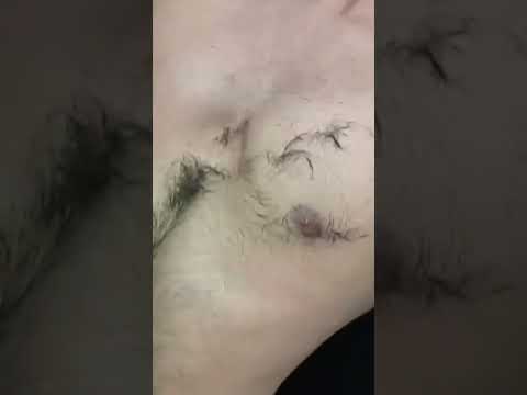 #chesthair #chesttrim #shaved #lahoribarber #chestmassage #hairremove #asmr #asmrnotalking