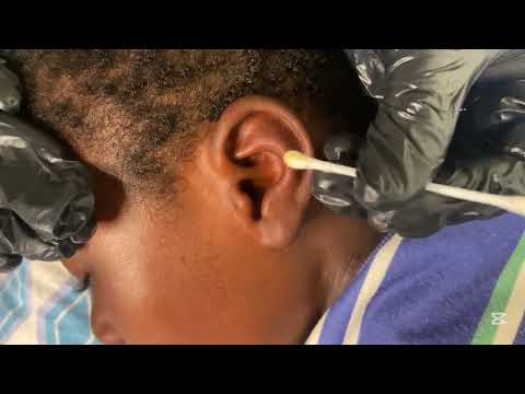ASMR PROFESSIONAL EAR CLEANING AND PICKING FOR VERY SATISFYING SLEEP NO GUM CHEWING