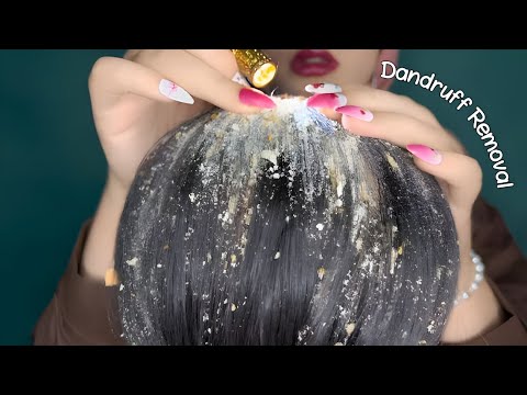 Relaxing Scalp Care & Gentle Dandruff Removal 💆🏻‍♀️ | ASMR Hair Treatment for Deep Sleep