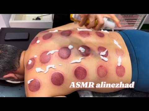 Asmr massage😍#explore #asmr #video #viralvideo #massage #cupping #youtubegaming