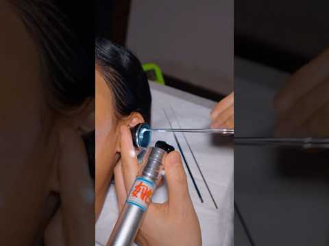 ASMR: Traditional Chinese Ear Cleaning and Head Water Massage #shorts