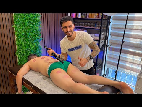 Professional Cupping Massage Therapy to Release Deep Muscle Tension
