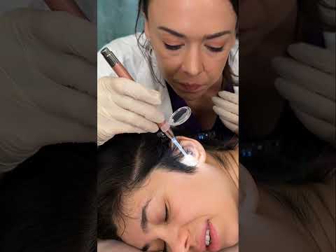 Asmr scalp tingles #asmr #asmrsounds #asmrvideo #relax #relaxing #satisfying #hair #sleep #tingles