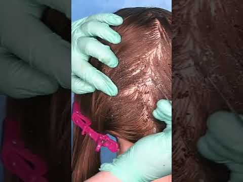 ASMR School Nurse Lice Check #shorts