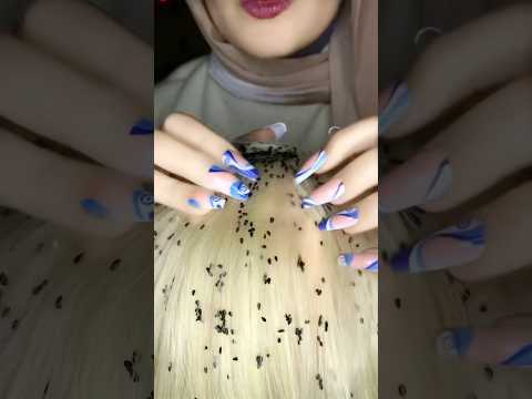 Lice removal 🐜💆🏻‍♀️ #asmr #satisfying #visualtingle #relaxing #mouthwhisper #relax #shorts #relax
