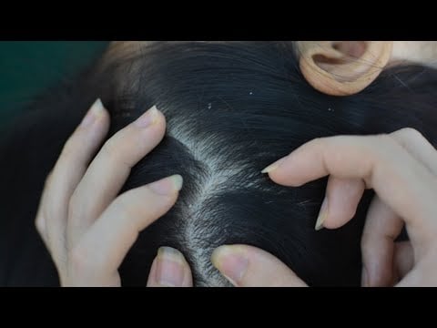 ASMR Scalp Check Real Person, Scalp Massage Tingling For Sleep
