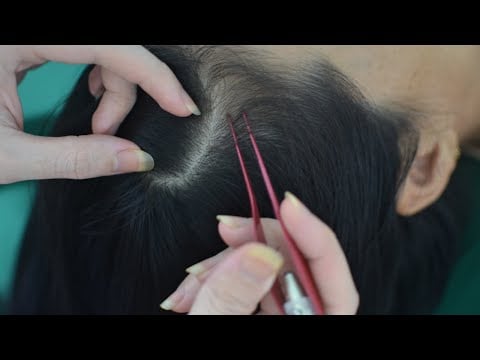 ASMR Head Scratching Aggressive For Relieve Itchy Scalp, Stress Make You Feel Relax