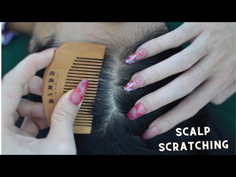 ASMR Scalp Scratching Aggressive, Real Person Scalp Massage, Therapy Sounds For Headache Relief
