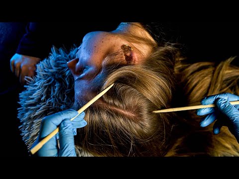 Ultimate ASMR Scalp Inspection on a REAL Person (No Talking)