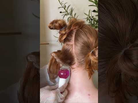 Asmr scalp tingles #asmr #asmrsounds #asmrvideo #relax #relaxing #satisfying #hair #sleep #tingles