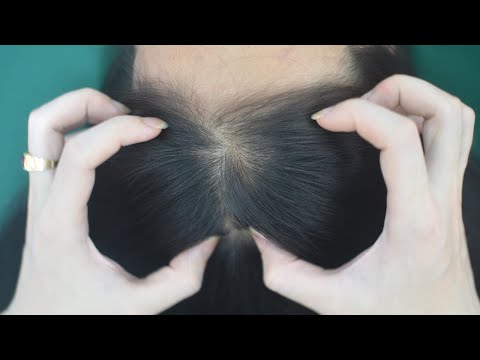 ASMR Scalp Scratching, Scalp Massage No Talking For Stress Relief ( Hair Sounds )