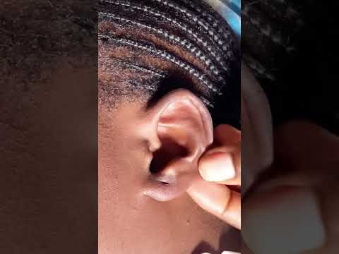 ASMR EAR PICKING AND CLEANING SO SATISFYING #asmr #relax #satisfying #earcleaning
