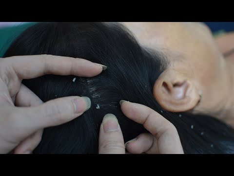 ASMR Scalp Check / Ear Check Relaxing For Sleep / No Talking