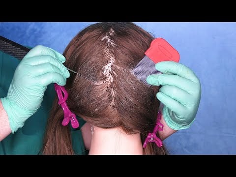 ASMR Scalp Check with Bad Results (Lice Check, Dandruff Removal, Scalp Treatment) Medical Roleplay
