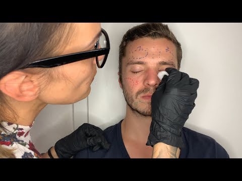 ASMR Face Allergy Test