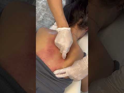 ASMR Chiro - Full Body CRUNCHES #painrelief #guasha
