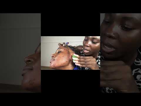 ASMR Ear Cleaning, Ear Eating, Ear Licking, Spit Painting, Ear Biting, Scalp Scratching For Sleep