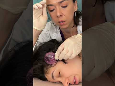 Asmr scalp tingles #asmr #asmrsounds #asmrvideo #relax #relaxing #satisfying #hair #sleep #tingles