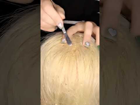 Dandruff Removal 💆🏻‍♀️#asmr #relax #visualtingle #satisfying #relaxing #tingles#asmrmassage#shorts