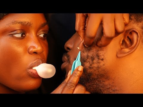 Asmr✨satisfying pimple pop,beard nitpicking, ineck massage, scalp and head massage with gum cracking