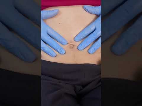 Belly Exam ASMR #asmr #roleplay #foryoupage Not a real Dr- fictional Roleplay