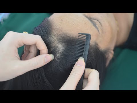 ASMR Nape Check & Hair Parting Real Person, Tingly Hair Sounds For Relieve Stress, Anxiety