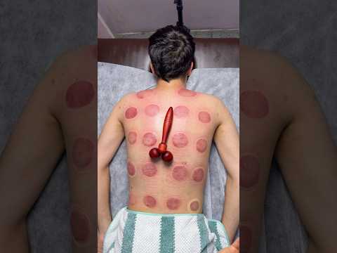 What do you think is red?!😂#explore #cupping #shortsviral #shorts #asmr #youtubeshorts