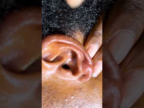 ASMR Ear Piercing Cleaning, Armpit Washing & Lymphatic Foot Body Massage for Deep Relaxation & Sleep