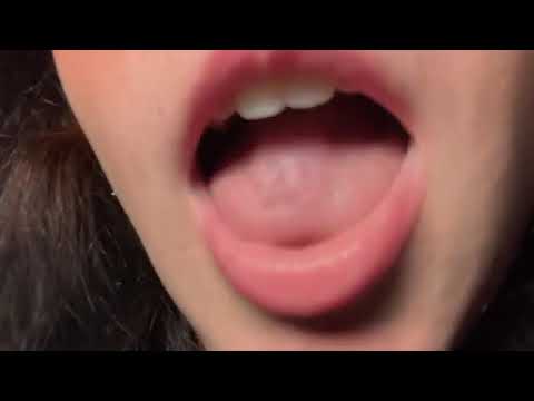 Lens licking 