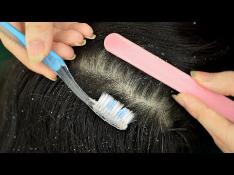 ASMR Scalp Check Relaxing For Sleep / Professional Scalp Cleansing / Medical Scalp Treatment