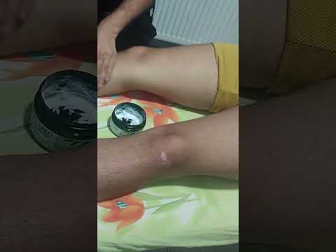 MASSAGE THERAPY THAT RELIEVES STRESS IN THE QUADRICEPS #satisfying #relaxing #asmr #shorts #massage