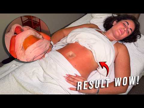 ASMR: Ovarian care therapy Massage, with fire Candle and Guasha in Malaysia