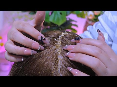 Dandruff Removal Treatment ASMR | Your Scalp's Serenade to Cleanse and Revive