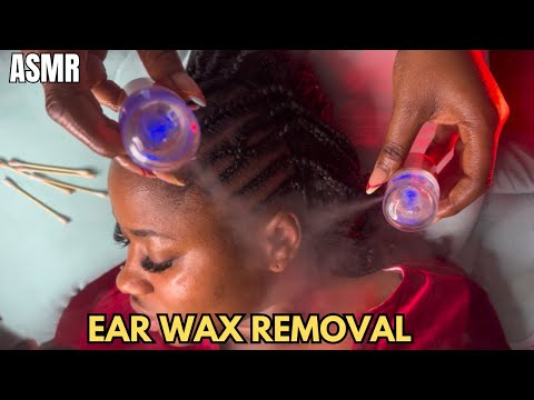 ASMR✨ DIRTIEST EAR DEEP CLEANING WITH BUDS& MIST SPRAY ” SATISFYING EAR WAX REMOVAL FOR DEEP SLEEP