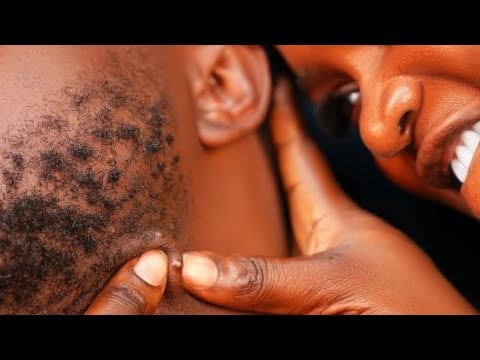 ASMR✨Intense Beard Scratching & Neck Massage (Ingrown Hair Removal + Nitpicking)4 Deep Sleep.+Gum