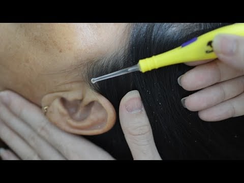ASMR Focus Scalp Check With Light, Scalp Scratching Aggressive For Relaxation