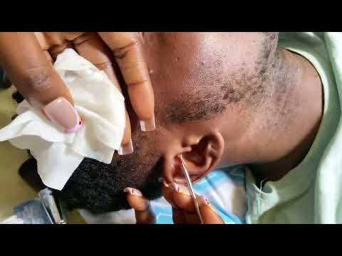 ASMR EAR 👂CLEANING VERY SATISFYING- RAIN-SOUND 🌧️