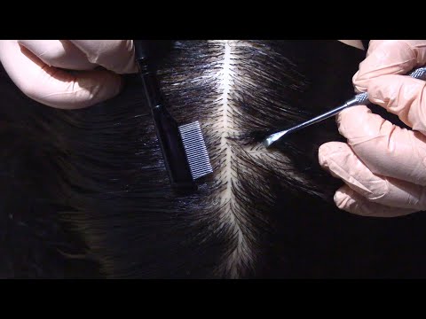 ASMR Scalp Check and Treatment (Lice Check, Scalp Massage, Lice Comb, Whispering) Medical Roleplay