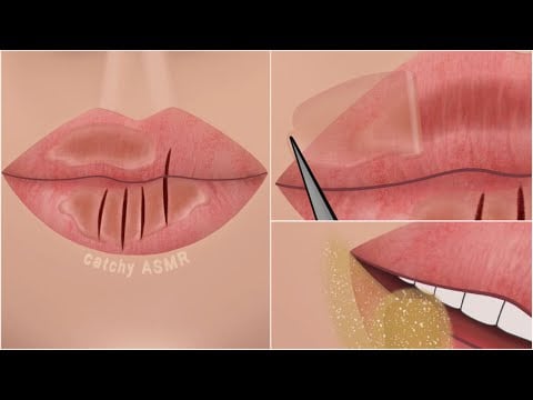 Lip care animation || Removal of dead cells of chapped lips || ASMR animation.