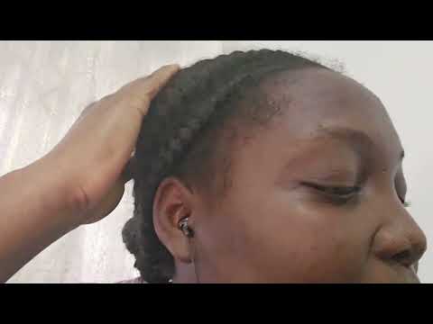 ASMR Scalp Scratching + Chit Chat Labor & Delivery Story👶🎀 