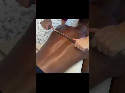 His Skin was Scraped to Release all the Best CRUNCHES. Recovery from injury #shorts #asmr #fyp