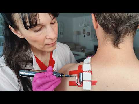 Allergy Skin Check Up & Test On The Shoulder ASMR