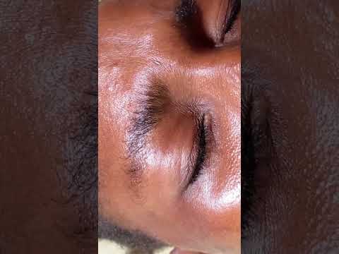 Asmr face cleaning and nitpicking #asmr #tingling #satisfying