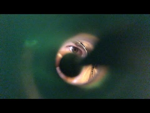 ASMR Eye Removal From Ear Canal - Chaotic Roleplay