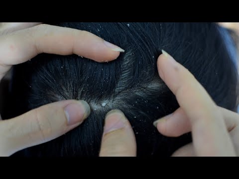 ASMR Relaxing Scalp Check For Sleep ( Scratching, Combing, Brushing ) No Talking
