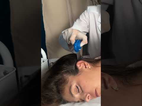 Asmr scalp tingles #asmr #asmrsounds #asmrvideo #relax #relaxing #satisfying #hair #sleep #tingles