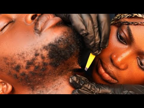 ASMR✨I Put my husband  to Sleep 😴 Relaxing Beard Grooming, Scratching, Shavin & Ingrown Hair Removal
