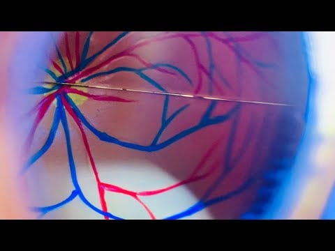 ASMR: You’re the Ophthalmoscope