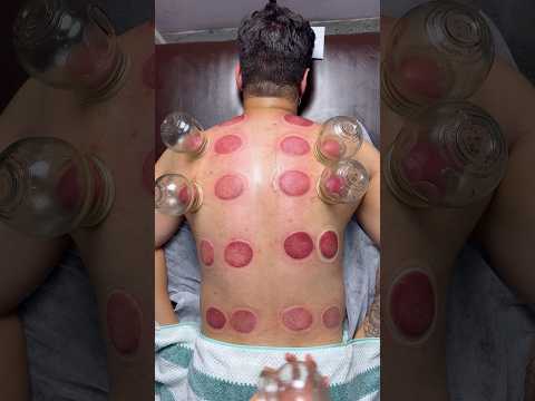pizza peperoni Alinezhad😍🍕#pizza #cupping #cuppingtherapy #explore #shorts #youtubeshorts #asmr